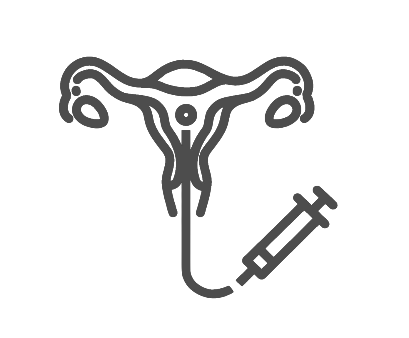 Illustration of intrauterine insemination (IUI) procedure showing a uterus, fallopian tubes, and syringe catheter used to insert sperm.